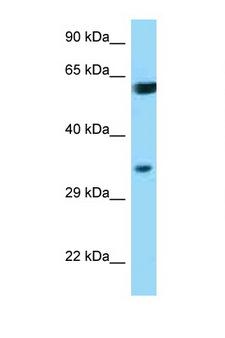 BAG1 / BAG-1 Antibody - BAG1 antibody Western blot of HeLa Cell lysate. Antibody concentration 1 ug/ml. This image was taken for the unconjugated form of this product. Other forms have not been tested.