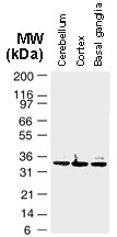 BAG1 / BAG-1 Antibody - Western blot of BAG-1 in normal brain tissue lysates using Polyclonal Antibody to BAG-1 at 1:2000.