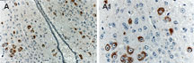 BAG1 / BAG-1 Antibody - Formalin-fixed, paraffin-embedded mouse ischemic brain stained for BAG-1 expression using Polyclonal Antibody to BAG-1 at 1:2000. A1 is a higher magnification of A. DifferentialBag1 expression levels are seen in the hypothalamic nuclei. The variation in expression levels from lack of Bag1 staining to strong staining may be linked to differential responses of the hypothalamic nuclei to ischemic stress. Hematoxylin-Eos in counterstain.