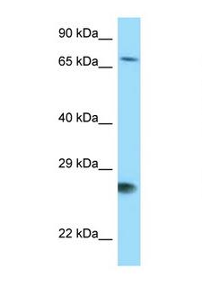BAG1 / BAG-1 Antibody - BAG1 antibody Western blot of 721_B Cell lysate. Antibody concentration 1 ug/ml.  This image was taken for the unconjugated form of this product. Other forms have not been tested.