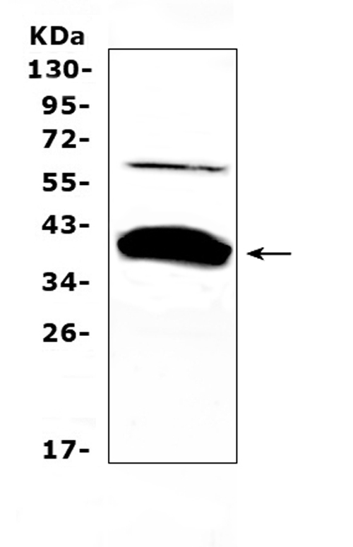 BAG1 / BAG-1 Antibody - Western blot analysis of Bag1 using anti-Bag1 antibody. Electrophoresis was performed on a 5-20% SDS-PAGE gel at 70V (Stacking gel) / 90V (Resolving gel) for 2-3 hours. The sample well of each lane was loaded with 50ug of sample under reducing conditions. Lane 1: rat kidney tissue lysates. After Electrophoresis, proteins were transferred to a Nitrocellulose membrane at 150mA for 50-90 minutes. Blocked the membrane with 5% Non-fat Milk/ TBS for 1.5 hour at RT. The membrane was incubated with rabbit anti-Bag1 antigen affinity purified polyclonal antibody at 0.5 µg/mL overnight at 4°C, then washed with TBS-0.1% Tween 3 times with 5 minutes each and probed with a goat anti-rabbit IgG-HRP secondary antibody at a dilution of 1:10000 for 1.5 hour at RT. The signal is developed using an Enhanced Chemiluminescent detection (ECL) kit with Tanon 5200 system. A specific band was detected for Bag1 at approximately 39KD. The expected band size for Bag1 is at 39KD.