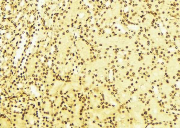 BAG1 / BAG-1 Antibody - 1:100 staining mouse liver tissue by IHC-P. The sample was formaldehyde fixed and a heat mediated antigen retrieval step in citrate buffer was performed. The sample was then blocked and incubated with the antibody for 1.5 hours at 22°C. An HRP conjugated goat anti-rabbit antibody was used as the secondary.