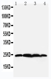 BAG2 Antibody - WB of BAG2 antibody. Lane 1: Rat Testis Tissue Lysate. Lane 2: HELA Cell Lysate. Lane 3: A549 Cell Lysate. Lane 4: A431 Cell Lysate.