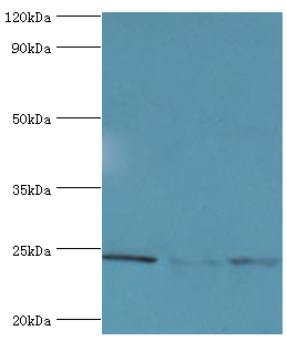 BAG2 Antibody - Western blot. All lanes: BAG family molecular chaperone regulator 2 antibody at 6 ug/ml. Lane 1: Jurkat whole cell lysate. Lane 2: HeLa whole cell lysate. Lane 3: HepG2 whole cell lysate. secondary Goat polyclonal to rabbit at 1:10000 dilution. Predicted band size: 24 kDa. Observed band size: 24 kDa.