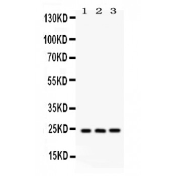BAG2 Antibody - BAG2 antibody Western blot. All lanes: Anti BAG2 at 0.5 ug/ml. Lane 1: Rat Testis Tissue Lysate at 50 ug. Lane 2: HELA Whole Cell Lysate at 40 ug. Lane 3: A549 Whole Cell Lysate at 40 ug. Predicted band size: 24 kD. Observed band size: 24 kD.
