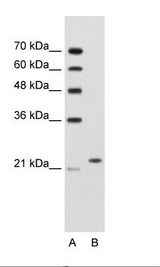 BAG2 Antibody - A: Marker, B: Jurkat Cell Lysate.  This image was taken for the unconjugated form of this product. Other forms have not been tested.