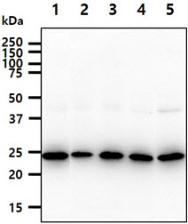 BAG2 Antibody - The cell lysates (40ug) were resolved by SDS-PAGE, transferred to PVDF membrane and probed with anti-human BAG2 antibody (1:1000). Proteins were visualized using a goat anti-mouse secondary antibody conjugated to HRP and an ECL detection system. Lane 1.: Jurkat cell lysate Lane 2.: A549 cell lysate Lane 3.: K562 cell lysate Lane 4.: HepG2 cell lysate Lane 5.: HeLa cell lysate