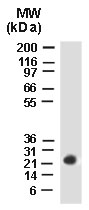 BAG2 Antibody - Western blot of BAG-2 using Polyclonal Antibody to BAG-2 at 1:2000. HeLa stably transfected Myc-tagged CHIP (