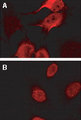 BAG2 Antibody - Immunofluorescence confocal microscopy of BAG-2 using Polyclonal Antibody to BAG-2 at 1:2000. HeLa cells stably transfected with Myc-CHIP (