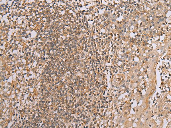 BAG2 Antibody - Immunohistochemistry of paraffin-embedded Human tonsil tissue  using BAG2 Polyclonal Antibody at dilution of 1:40(×200)