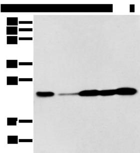 BAG2 Antibody - Western blot analysis of A549 A431 Hela Jurkat and HEPG2 cell  using BAG2 Polyclonal Antibody at dilution of 1:300