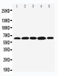 BAG3 / BAG-3 Antibody - WB of BAG3 / BAG-3 antibody. Lane 1: MCF-7 Cell Lysate. Lane 2: JURKAT Cell Lysate. Lane 3: A549 Cell Lysate. Lane 4: HELA Cell Lysate. Lane 5: COLO320 Cell Lysate.