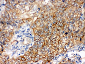 BAG3 / BAG-3 Antibody