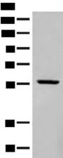 BAG3 / BAG-3 Antibody - Western blot analysis of Mouse heart tissue lysate  using BAG3 Polyclonal Antibody at dilution of 1:250