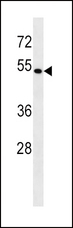 BAG4 / SODD Antibody - BAG4 Antibody western blot of HeLa cell line lysates (35 ug/lane). The BAG4 antibody detected the BAG4 protein (arrow).