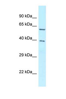 BAG4 / SODD Antibody - BAG4 / SODD antibody Western blot of 8226 Cell lysate. Antibody concentration 1 ug/ml.  This image was taken for the unconjugated form of this product. Other forms have not been tested.