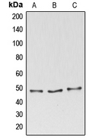 BAG4 / SODD Antibody - Western blot analysis of BAG4 expression in HeLa (A); MOLT4 (B); THP1 (C) whole cell lysates.
