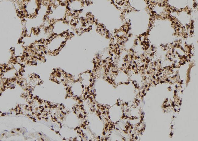 BAG4 / SODD Antibody - 1:100 staining rat lung tissue by IHC-P. The sample was formaldehyde fixed and a heat mediated antigen retrieval step in citrate buffer was performed. The sample was then blocked and incubated with the antibody for 1.5 hours at 22°C. An HRP conjugated goat anti-rabbit antibody was used as the secondary.
