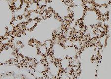 BAG4 / SODD Antibody - 1:100 staining rat lung tissue by IHC-P. The sample was formaldehyde fixed and a heat mediated antigen retrieval step in citrate buffer was performed. The sample was then blocked and incubated with the antibody for 1.5 hours at 22°C. An HRP conjugated goat anti-rabbit antibody was used as the secondary.