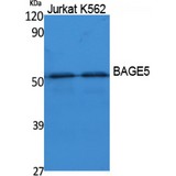 BAG5 Antibody - Western blot of BAGE5 antibody