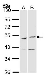 BAG5 Antibody - Sample (30 ug of whole cell lysate). A: Hela, B: Molt-4 . 10% SDS PAGE. BAG5 antibody diluted at 1:1000.