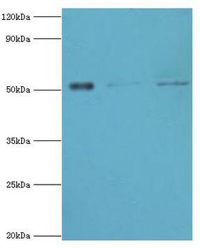 BAG5 Antibody - Western blot. All lanes: BAG family molecular chaperone regulator 5 antibody at 1 ug/ml. Lane 1: HeLa whole cell lysate. Lane 2: Jurkat whole cell lysate. Lane 3: A549 whole cell lysate. secondary Goat polyclonal to rabbit at 1:10000 dilution. Predicted band size: 51 kDa. Observed band size: 51 kDa.