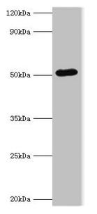 BAG5 Antibody - Western blot All lanes: BAG5 antibody at 1µg/ml + A549 whole cell lysate Secondary Goat polyclonal to rabbit IgG at 1/10000 dilution Predicted band size: 52, 57 kDa Observed band size: 52 kDa
