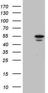 BAG5 Antibody - HEK293T cells were transfected with the pCMV6-ENTRY control. (Left lane) or pCMV6-ENTRY BAG5. (Right lane) cDNA for 48 hrs and lysed