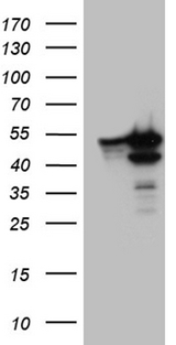 BAG5 Antibody - HEK293T cells were transfected with the pCMV6-ENTRY control. (Left lane) or pCMV6-ENTRY BAG5. (Right lane) cDNA for 48 hrs and lysed. Equivalent amounts of cell lysates. (5 ug per lane) were separated by SDS-PAGE and immunoblotted with anti-BAG5. (1:2000)