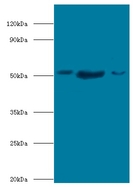 BAG5 Antibody - Western blot of BAG family molecular chaperone regulator 5 antibody at 2 ug/ml lane 1: mouse kidney tissue lane 2: mouse brain tissue Lane 3: HeLa whole cell lysate secondary Goat polyclonal to rabbit at 1:10000 dilution predicted band size: 51 KDa observed band size: 51 KDa.  This image was taken for the unconjugated form of this product. Other forms have not been tested.