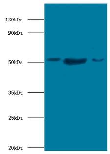 BAG5 Antibody - Western blot of BAG family molecular chaperone regulator 5 antibody at 2 ug/ml lane 1: mouse kidney tissue lane 2: mouse brain tissue Lane 3: HeLa whole cell lysate secondary Goat polyclonal to rabbit at 1:10000 dilution predicted band size: 51 KDa observed band size: 51 KDa.  This image was taken for the unconjugated form of this product. Other forms have not been tested.
