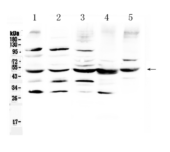 BAG5 Antibody - Western blot analysis of Bag5 using anti-Bag5 antibody. Electrophoresis was performed on a 5-20% SDS-PAGE gel at 70V (Stacking gel) / 90V (Resolving gel) for 2-3 hours. The sample well of each lane was loaded with 50ug of sample under reducing conditions. Lane 1: rat brain tissue lysates, Lane 2: mouse brain tissue lysates, Lane 3: HELA whole Cell lysates, Lane 4: MCF-7 whole cell lysates, Lane 5: SKOV3 whole cell lysates After Electrophoresis, proteins were transferred to a Nitrocellulose membrane at 150mA for 50-90 minutes. Blocked the membrane with 5% Non-fat Milk/ TBS for 1.5 hour at RT. The membrane was incubated with rabbit anti-Bag5 antigen affinity purified polyclonal antibody at 0.5 µg/mL overnight at 4°C, then washed with TBS-0.1% Tween 3 times with 5 minutes each and probed with a goat anti-rabbit IgG-HRP secondary antibody at a dilution of 1:10000 for 1.5 hour at RT. The signal is developed using an Enhanced Chemiluminescent detection (ECL) kit with Tanon 5200 system. A specific band was detected for Bag5 at approximately 51KD. The expected band size for Bag5 is at 51KD.