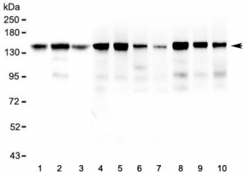 BAG6 / G3 / Scythe Antibody - Western blot testing of 1) human HeLa, 2) human ThP-1, 3) human U-87 MG, 4) rat brain, 5) rat heart, 6) rat lung, 7) rat liver, 8) mouse brain, 9) mouse heart and 10) mouse lung lysate with BAG6 antibody at 0.5ug/ml. Predicted molecular weight ~119 kDa but observed at 150-170 kDa.
