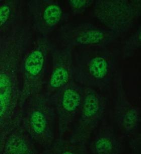 BAG6 / G3 / Scythe Antibody - IF/ICC staining of FFPE human U-2 OS cells with BAG6 antibody (green) at 2ug/ml. HIER: steam section in pH6 citrate buffer for 20 min.