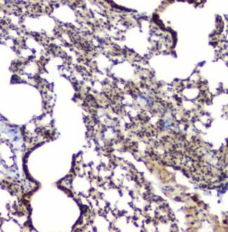 BAG6 / G3 / Scythe Antibody - IHC staining of FFPE mouse lung with BAG6 antibody at 1ug/ml. HIER: boil tissue sections in pH6, 10mM citrate buffer, for 10-20 min and allow to cool before testing.