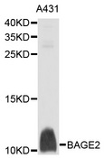 BAGE2 Antibody - Western blot analysis of extracts of A-431 cells, using BAGE2 antibody at 1:1000 dilution. The secondary antibody used was an HRP Goat Anti-Rabbit IgG (H+L) at 1:10000 dilution. Lysates were loaded 25ug per lane and 3% nonfat dry milk in TBST was used for blocking. An ECL Kit was used for detection and the exposure time was 90s.