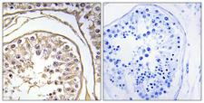 BAGE2 Antibody - Peptide - + Immunohistochemistry analysis of paraffin-embedded human testis tissue using BAGE2 antibody.