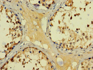 BAGE3 Antibody - Immunohistochemistry of paraffin-embedded human testis tissue using BAGE3 Antibody at dilution of 1:100