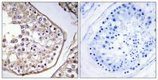BAGE3 Antibody - Peptide - + Immunohistochemistry analysis of paraffin-embedded human testis tissue using BAGE3 antibody.