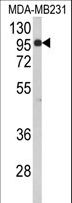 BAHD1 Antibody - Western blot of BAHD1 Antibody in MDA-MB231 cell line lysates (35 ug/lane). BAHD1 (arrow) was detected using the purified antibody.