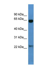BAIAP2 / IRSP53 Antibody - BAIAP2 / IRSP53 antibody Western blot of Mouse Heart lysate. This image was taken for the unconjugated form of this product. Other forms have not been tested.