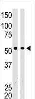 BAIAP2 / IRSP53 Antibody - The anti-BAIAP2 antibody is used in Western blot to detect BAIAP2 in mouse brain tissue lysate (Lane 1) and A375 cell lysate (Lane 2).