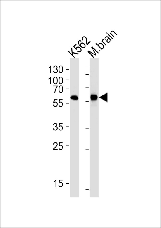 BAIAP2 / IRSP53 Antibody - BAIAP2 Antibody western blot of K562 cell line and mouse brain tissue lysates (35 ug/lane). The BAIAP2 antibody detected the BAIAP2 protein (arrow).