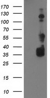 BAIAP2 / IRSP53 Antibody - HEK293T cells were transfected with the pCMV6-ENTRY control (Left lane) or pCMV6-ENTRY BAIAP2 (Right lane) cDNA for 48 hrs and lysed. Equivalent amounts of cell lysates (5 ug per lane) were separated by SDS-PAGE and immunoblotted with anti-BAIAP2.