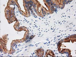 BAIAP2 / IRSP53 Antibody - IHC of paraffin-embedded Human prostate tissue using anti-BAIAP2 mouse monoclonal antibody.