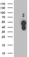 BAIAP2 / IRSP53 Antibody - HEK293T cells were transfected with the pCMV6-ENTRY control (Left lane) or pCMV6-ENTRY BAIAP2 (Right lane) cDNA for 48 hrs and lysed. Equivalent amounts of cell lysates (5 ug per lane) were separated by SDS-PAGE and immunoblotted with anti-BAIAP2.
