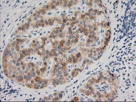 BAIAP2 / IRSP53 Antibody - IHC of paraffin-embedded Human pancreas tissue using anti-BAIAP2 mouse monoclonal antibody.