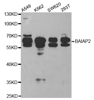 BAIAP2 / IRSP53 Antibody - Western blot analysis of extracts of various cell lines, using BAIAP2 antibody.