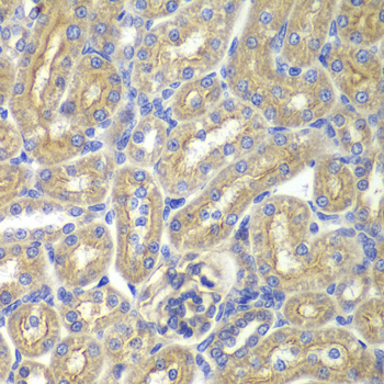 BAIAP2 / IRSP53 Antibody - Immunohistochemistry of paraffin-embedded rat kidney tissue.