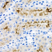 BAIAP2 / IRSP53 Antibody - Immunohistochemical analysis of IRSp53 staining in rat kidney formalin fixed paraffin embedded tissue section. The section was pre-treated using heat mediated antigen retrieval with sodium citrate buffer (pH 6.0). The section was then incubated with the antibody at room temperature and detected using an HRP conjugated compact polymer system. DAB was used as the chromogen. The section was then counterstained with hematoxylin and mounted with DPX.